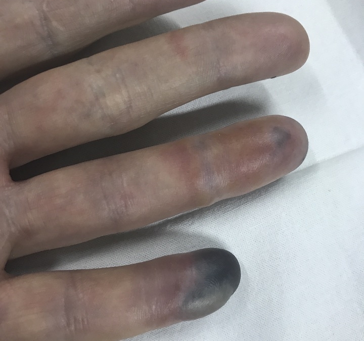 Finger0528