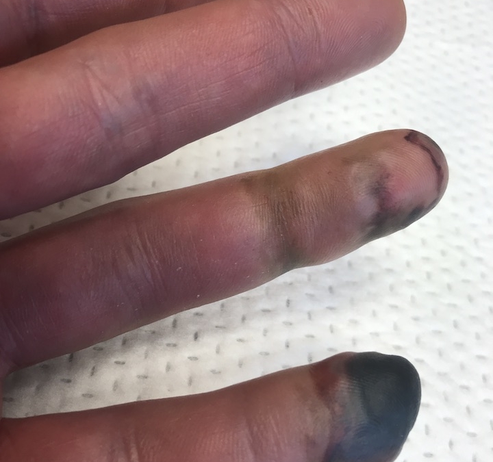 Finger0603
