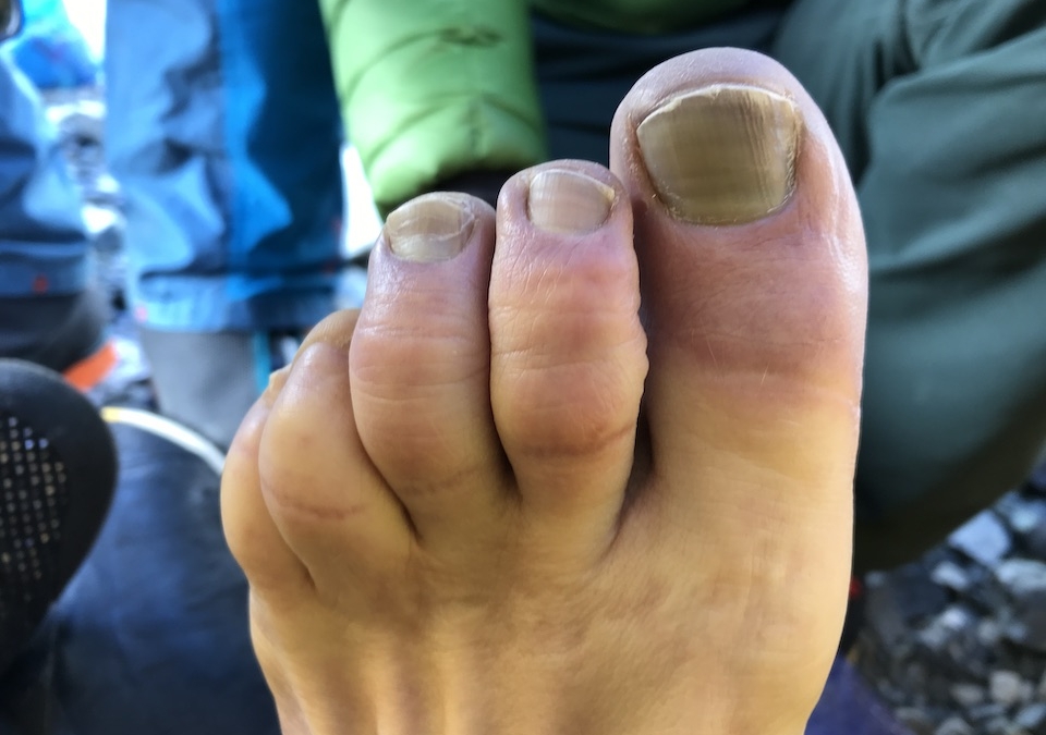 Toe0523
