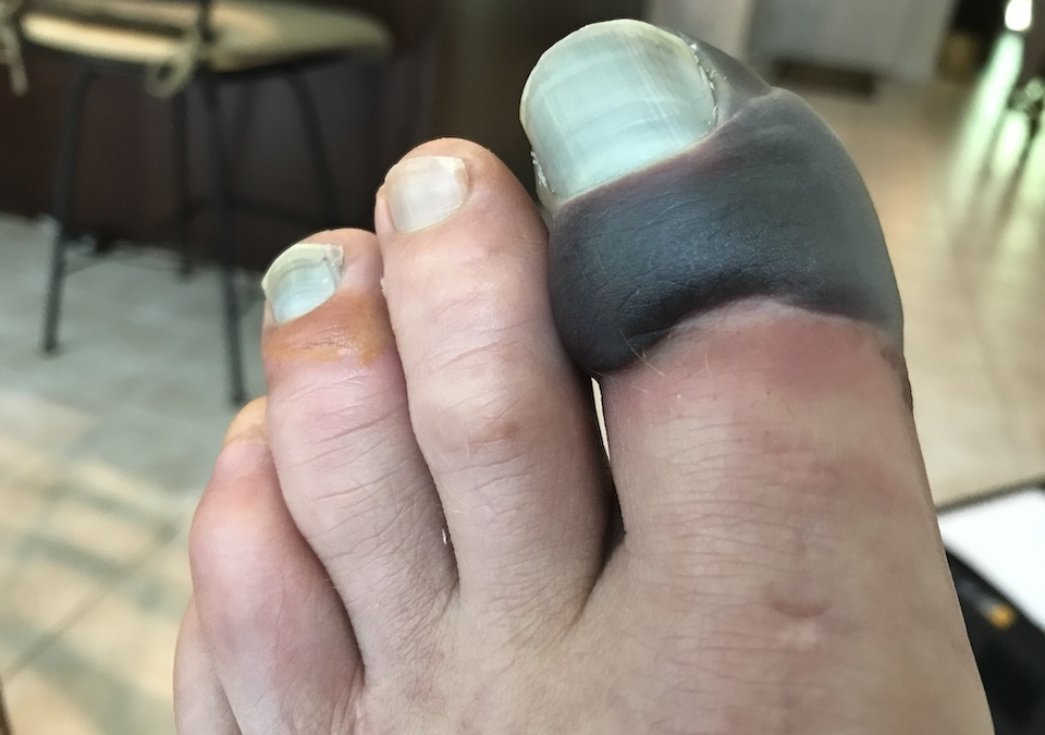 Toe0601