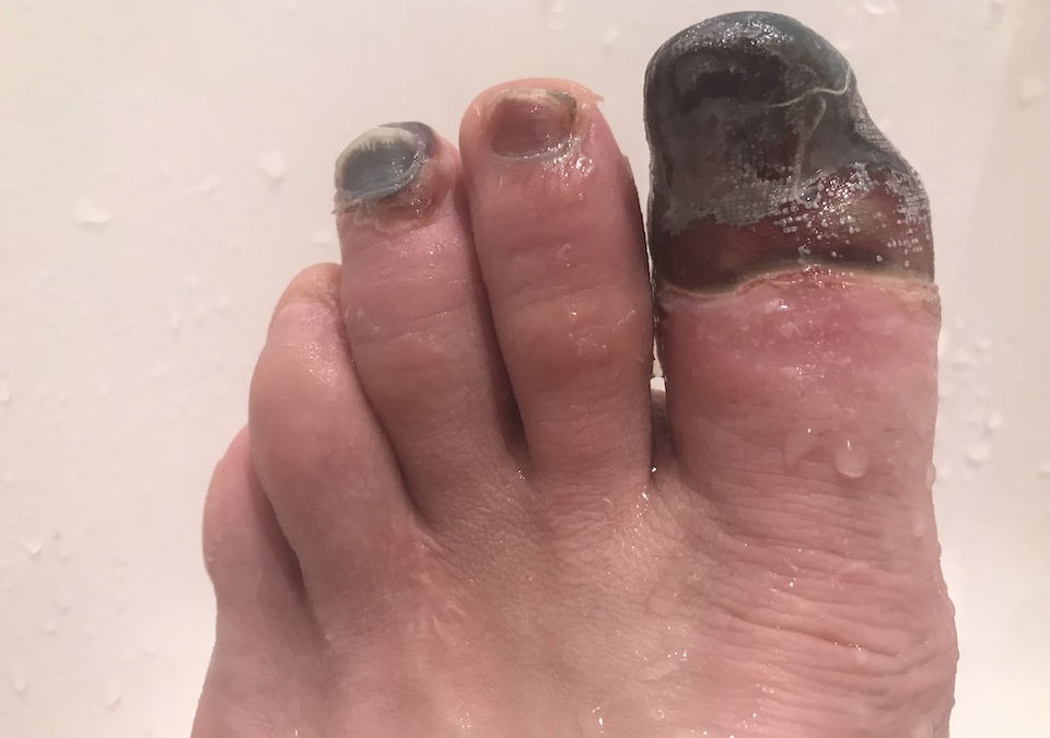 Toe0628
