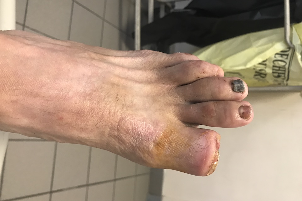 Foot today